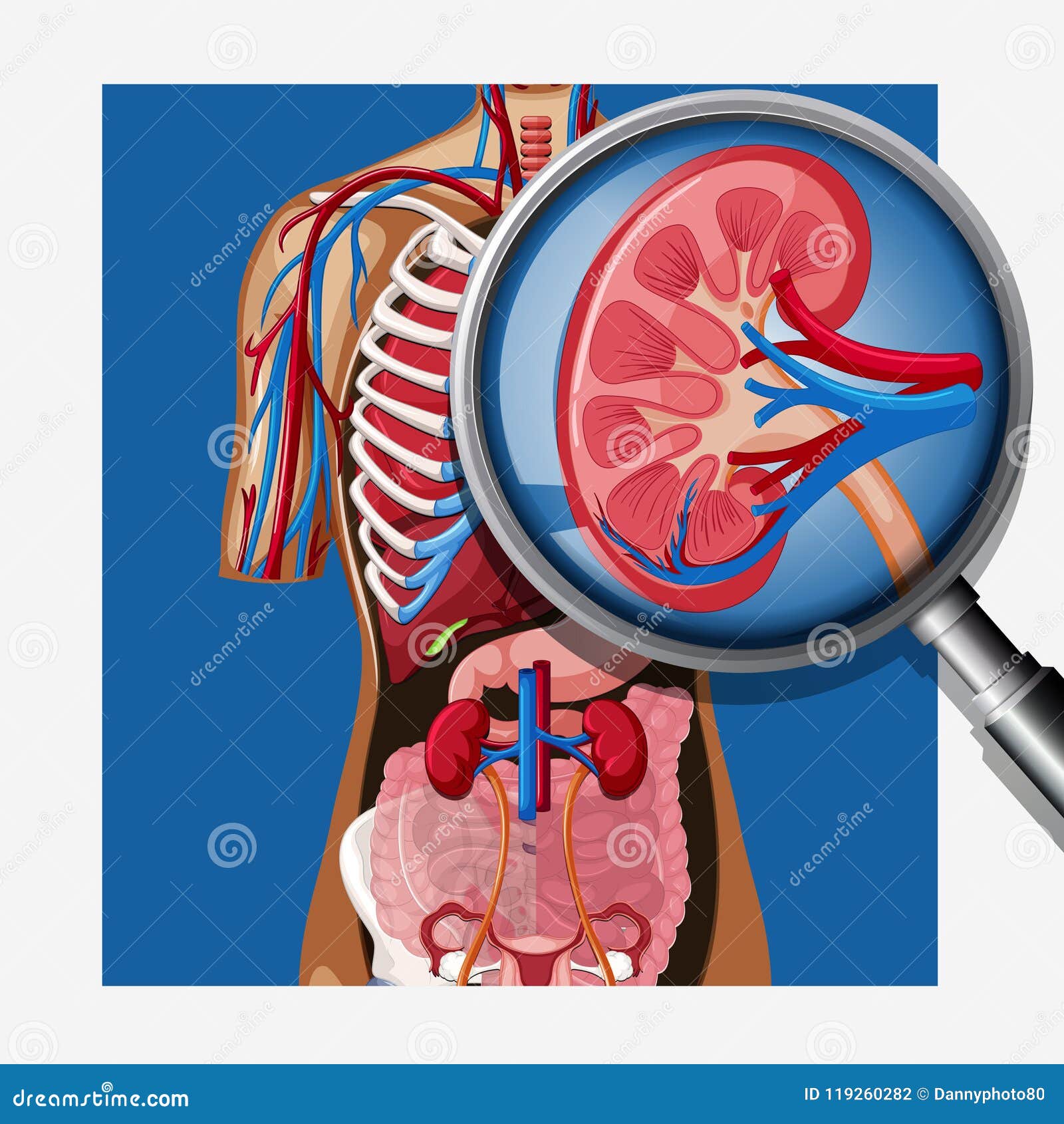 Kidney Failure Infographic Cartoon Vector | CartoonDealer.com #125972925