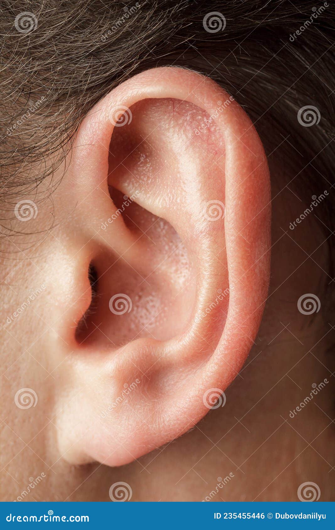Human Auricle, Men, Outer Ear, Structure and Anatomy, Hearing Loss and