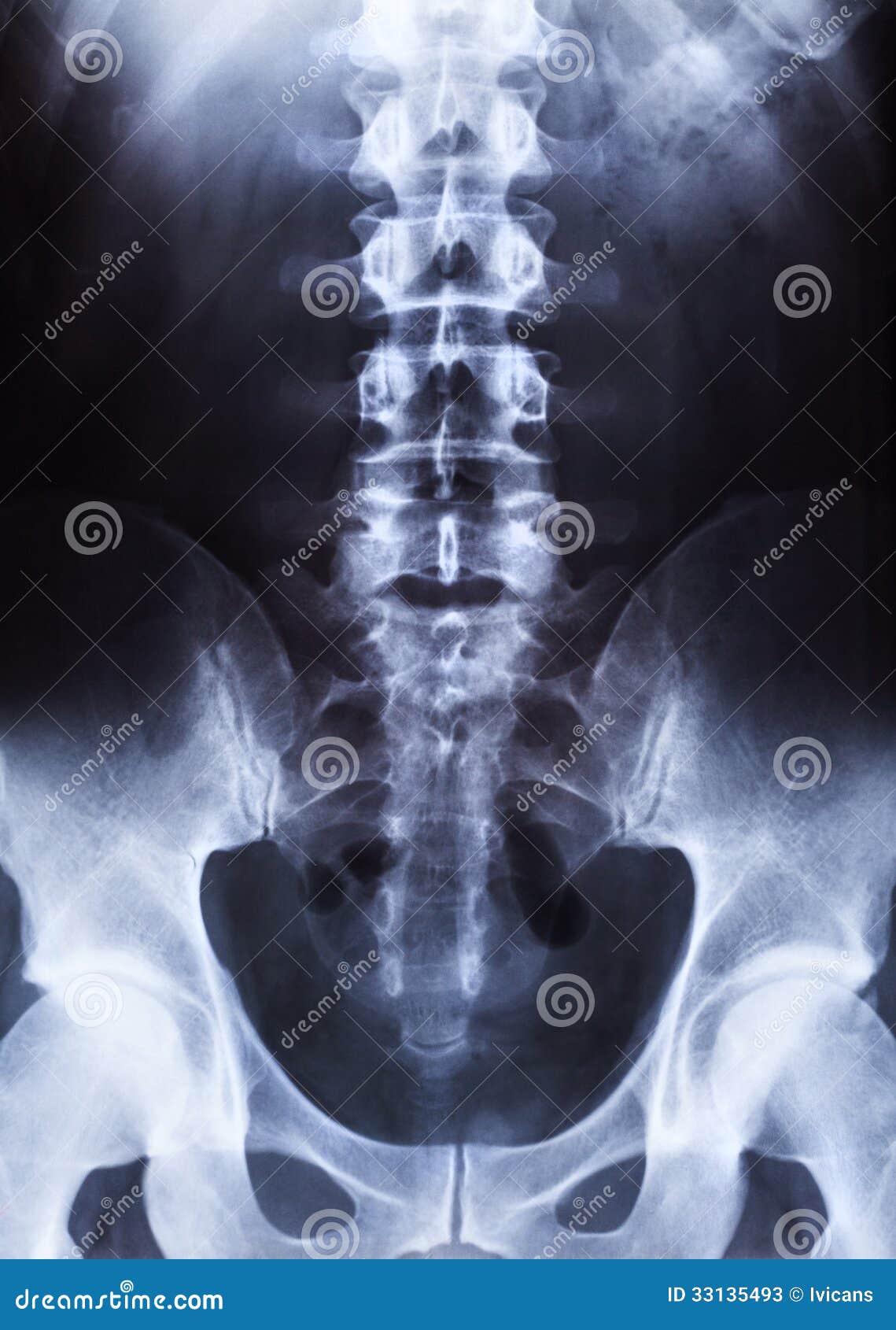 Human body on xray stock image. Image of hospital, health 33135493