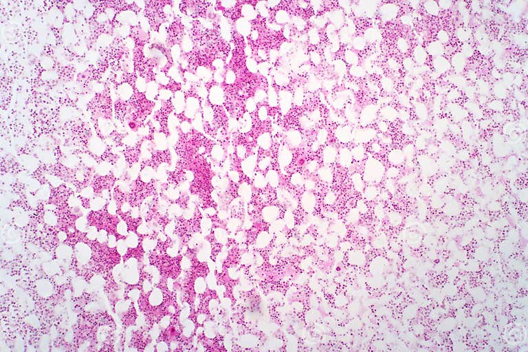 Human Bone Marrow Under the Light Microscope View Stock Image - Image