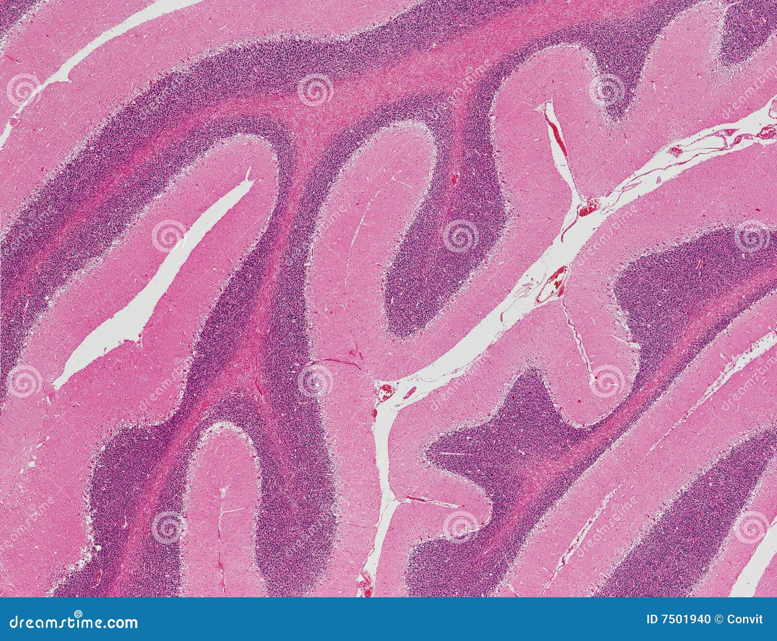 human brain (cerebellum)