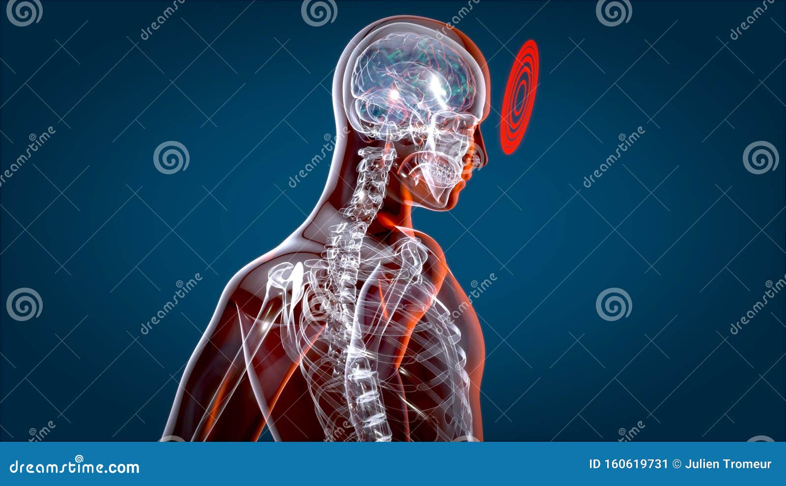 x10 xray vision x10 xray vision