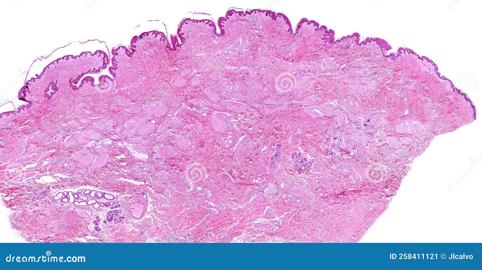 Human breast nipple stock image. Image of skin, gland 258411121