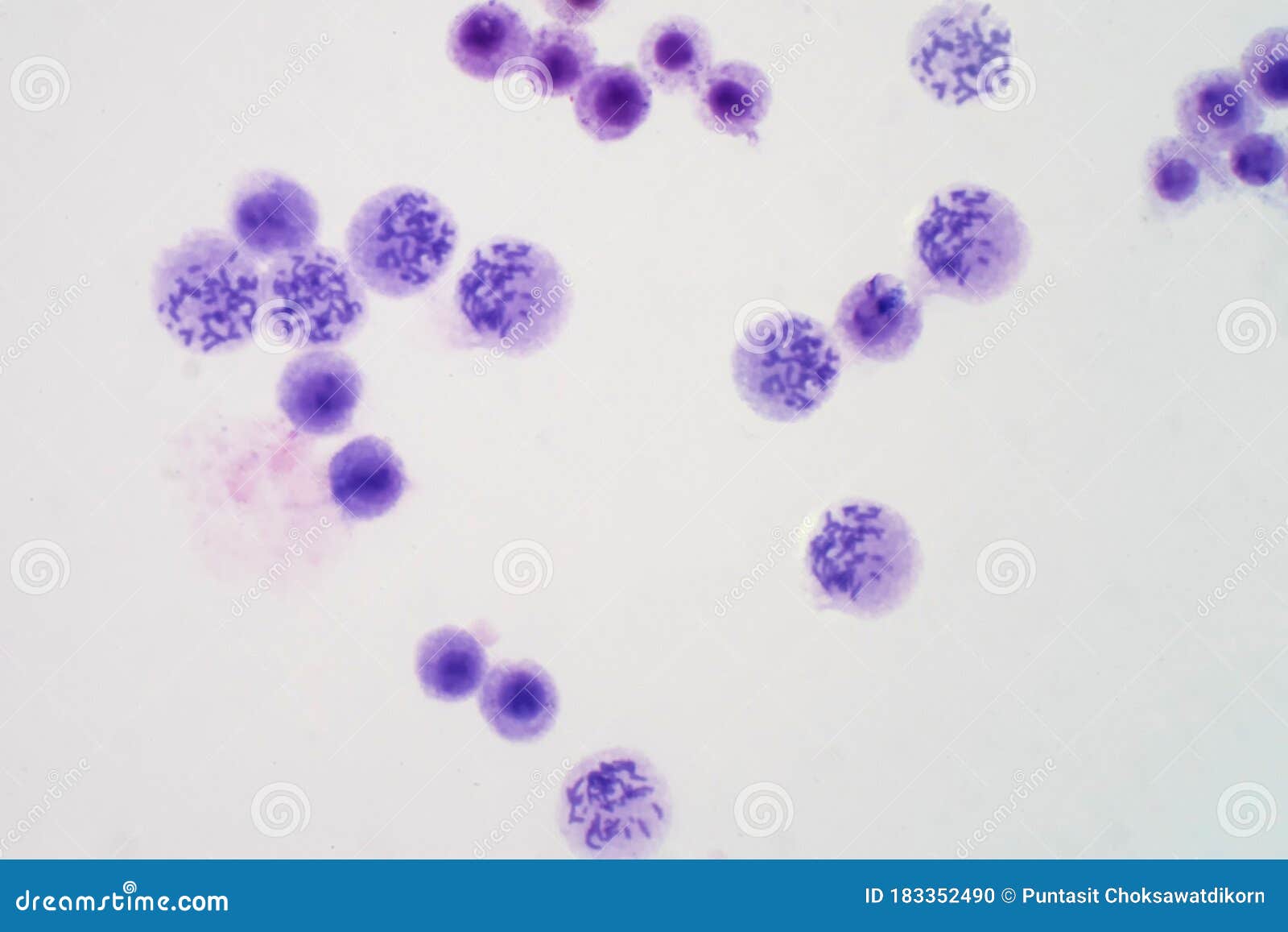 Human Chromosomes from Blood Under Microscope View Stock Photo Image