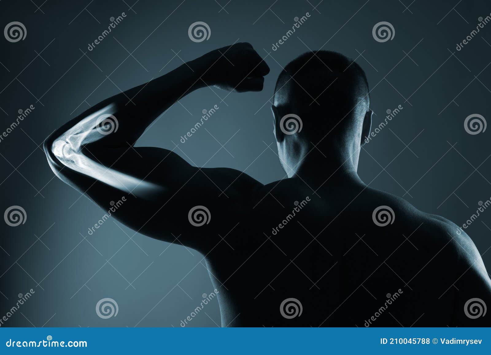 Human Elbow Joint in Xray, on Gray Background Stock Photo Image of