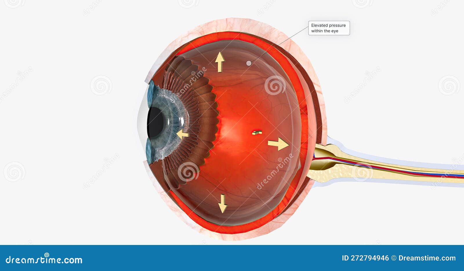 Human Eye (eye Disease Stock Illustration Illustration of