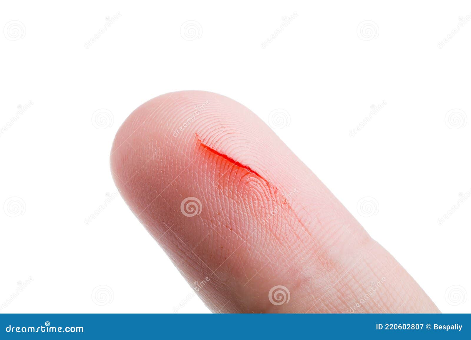 Bleeding Finger Images - Free Download on Freepik