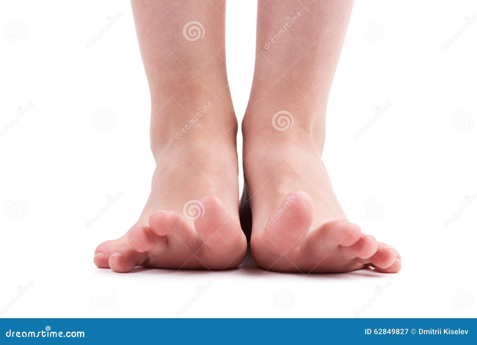 Human Foot with the Fingers Stock Image Image of platypodia, joint