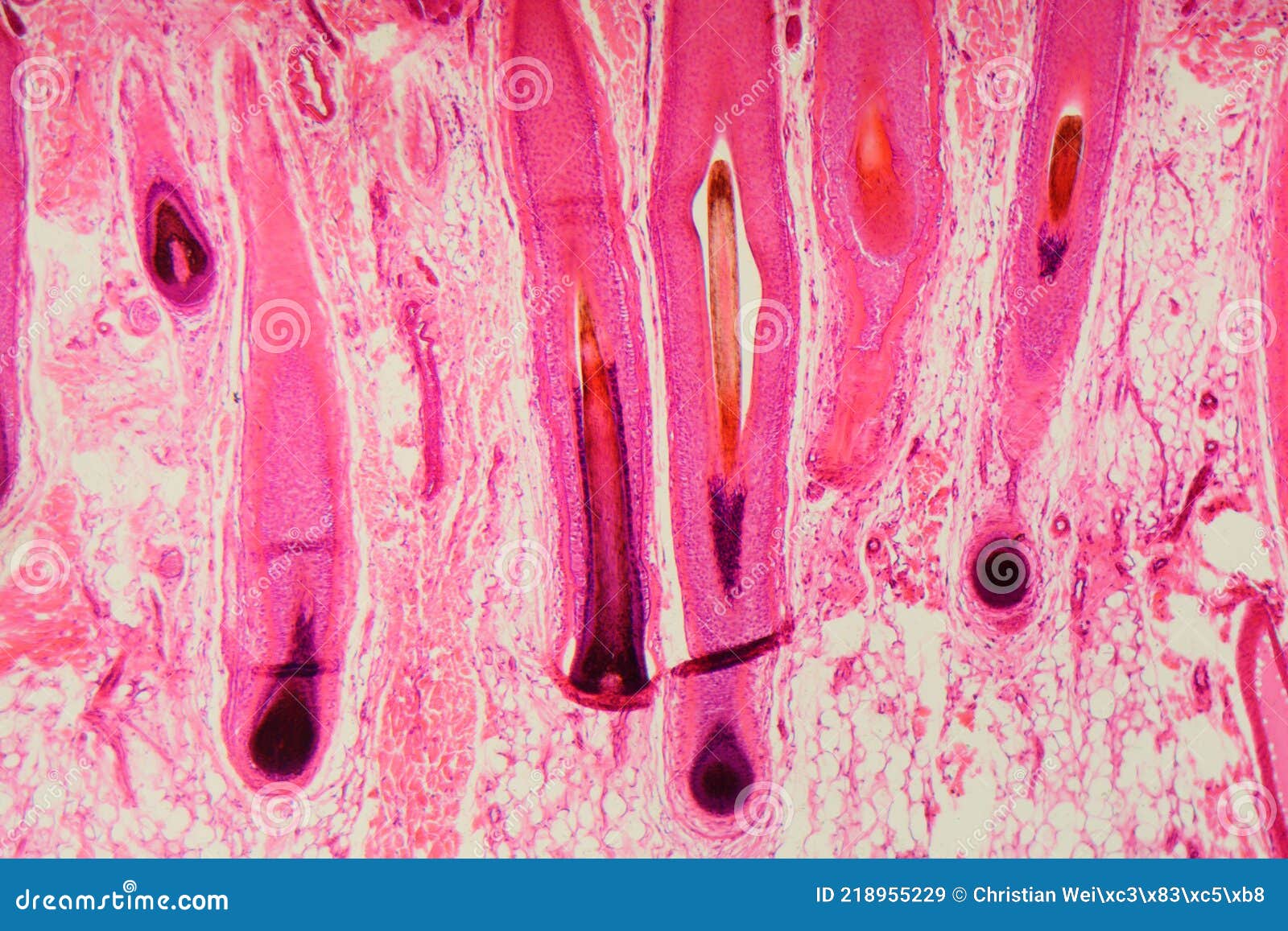 Human Hair Follicle in Skin Under the Microscope Stock Image - Image of  skin, follicle: 218955229