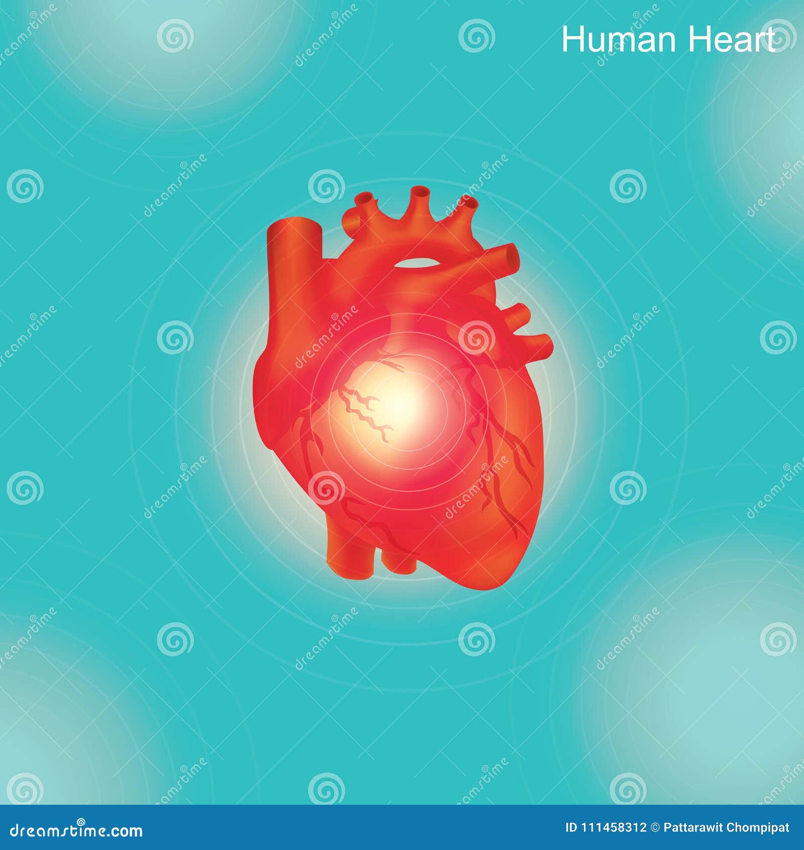 human heart.angioplasty is an endovascular procedure to widen narrowed or ob
