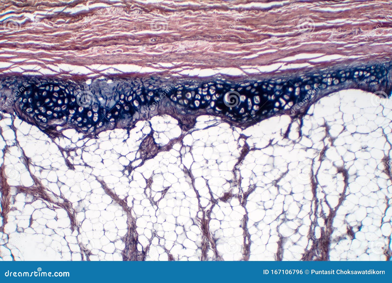 Human Hyaline Cartilage Bone Under Microscope View for Education