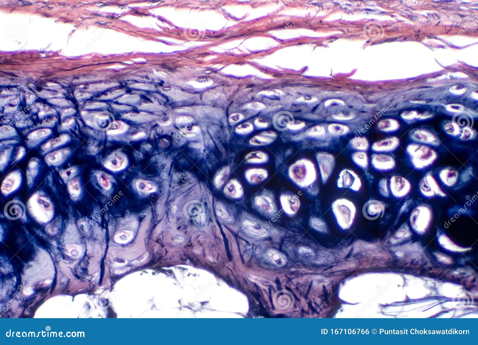 Human Hyaline Cartilage Bone Under Microscope View for Education