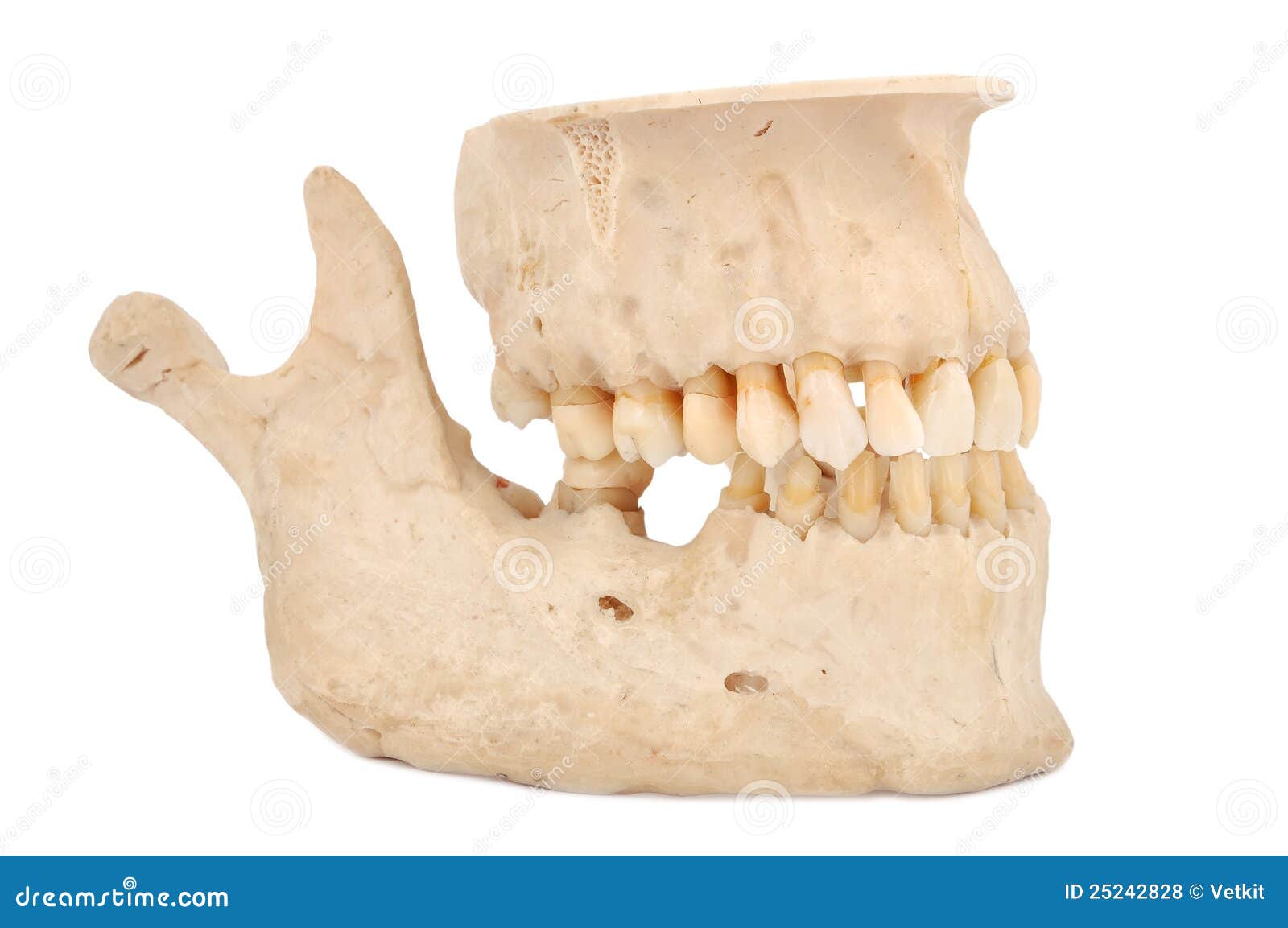 Human jaw stock photo. Image of bone, part, dental, healthcare - 25242828