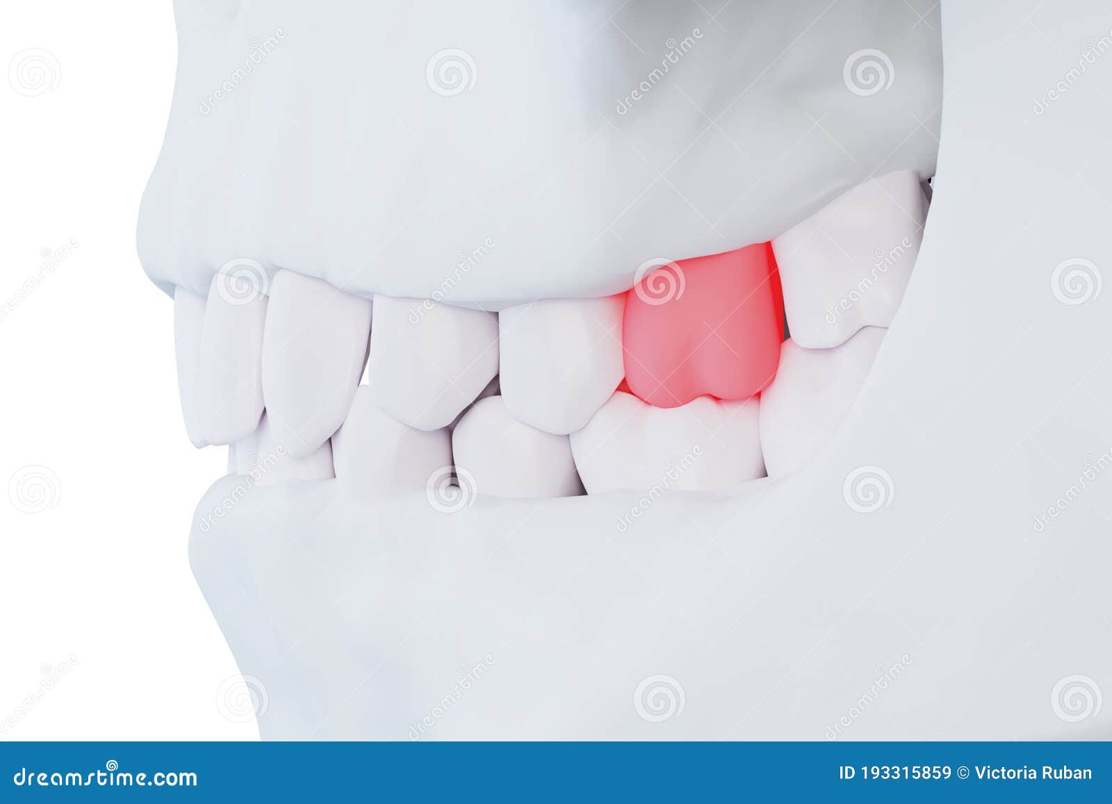 Tooth, Sore Gum, Redness, Dentistry, Dental Cleaning, Oral Hygiene