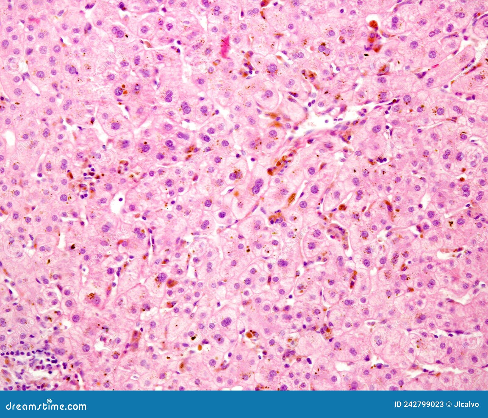 human liver. cholestasis