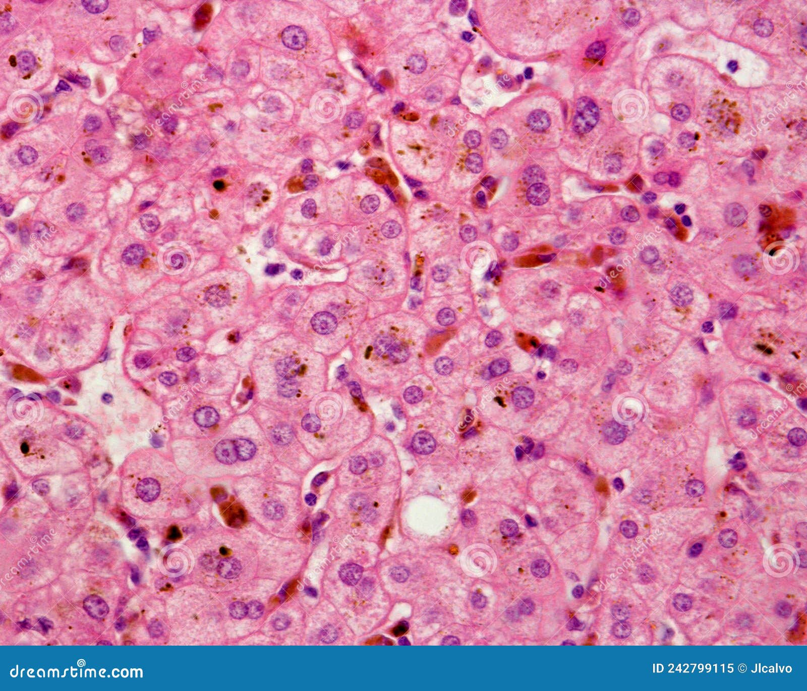 Human liver. Cholestasis stock image. Image of histological 242799115