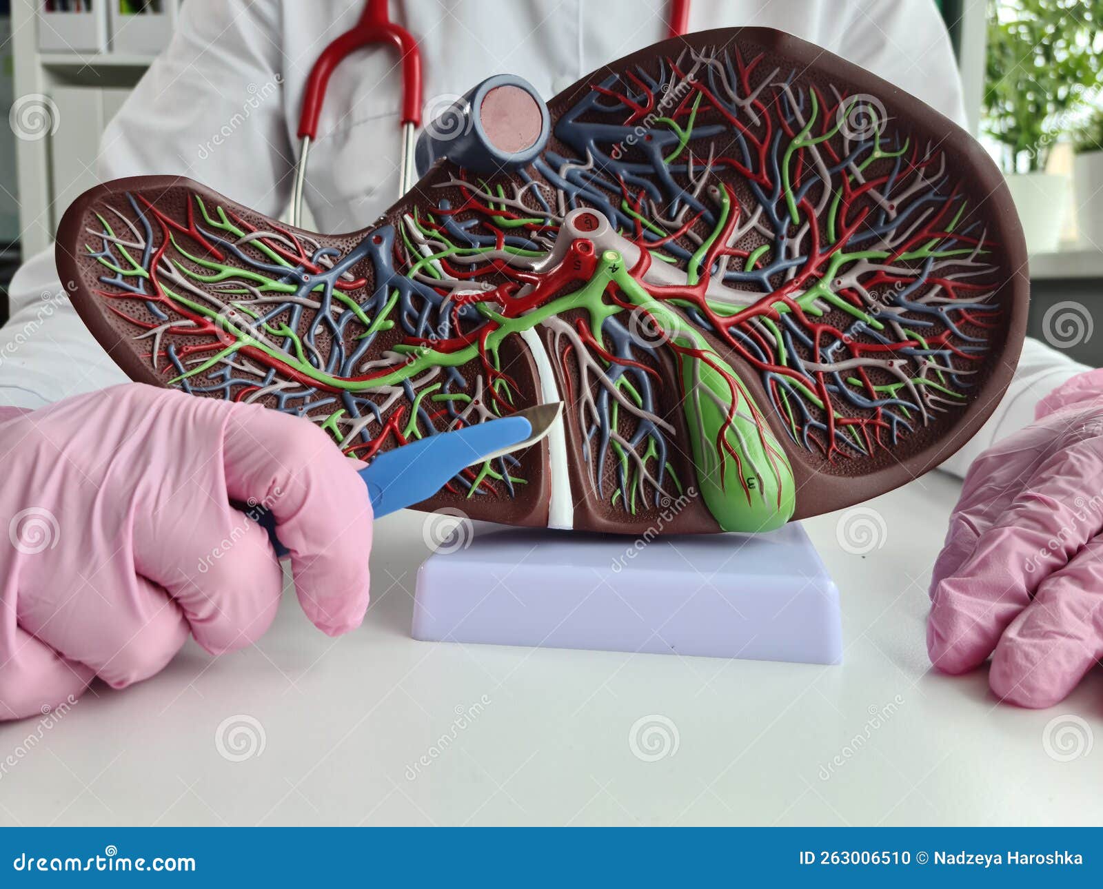 human liver model fibrous cirrhotic and cancerous