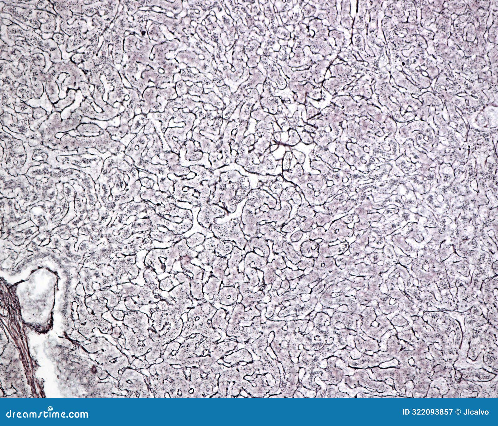 human liver. reticular fibers