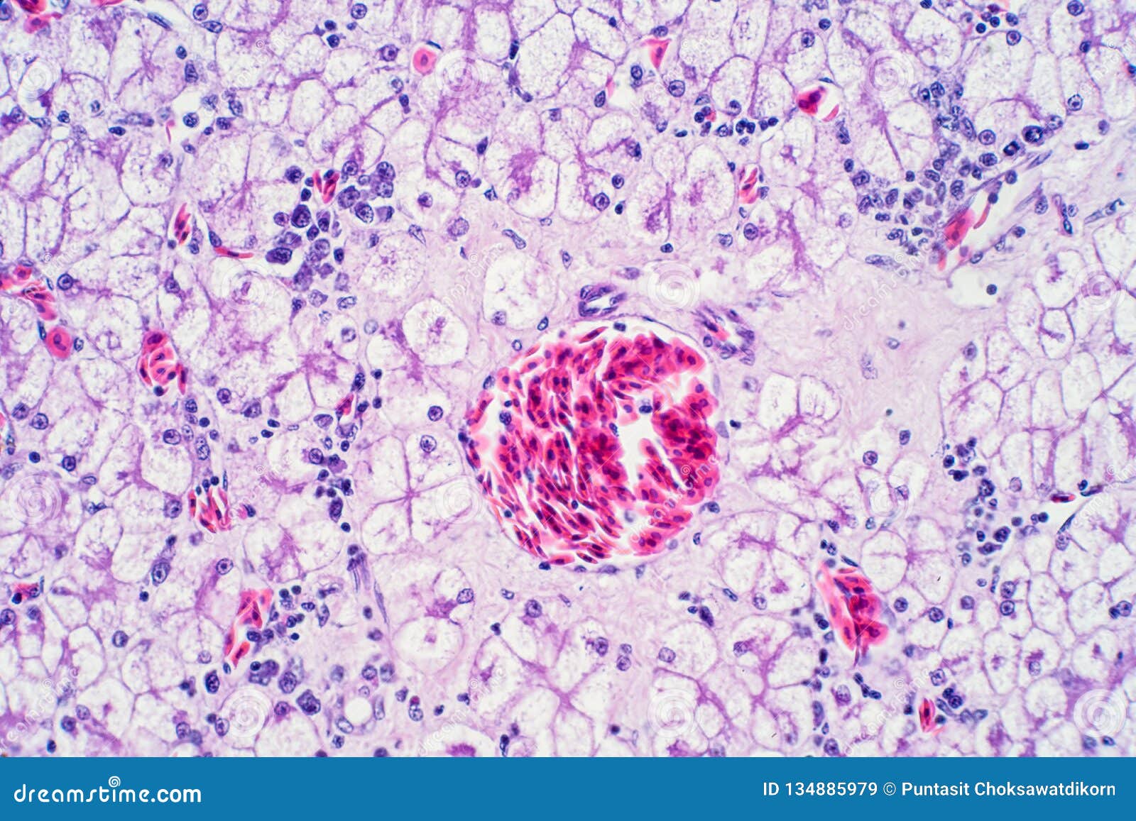 Human Liver Tissue Under the Microscope View Stock Image Image of