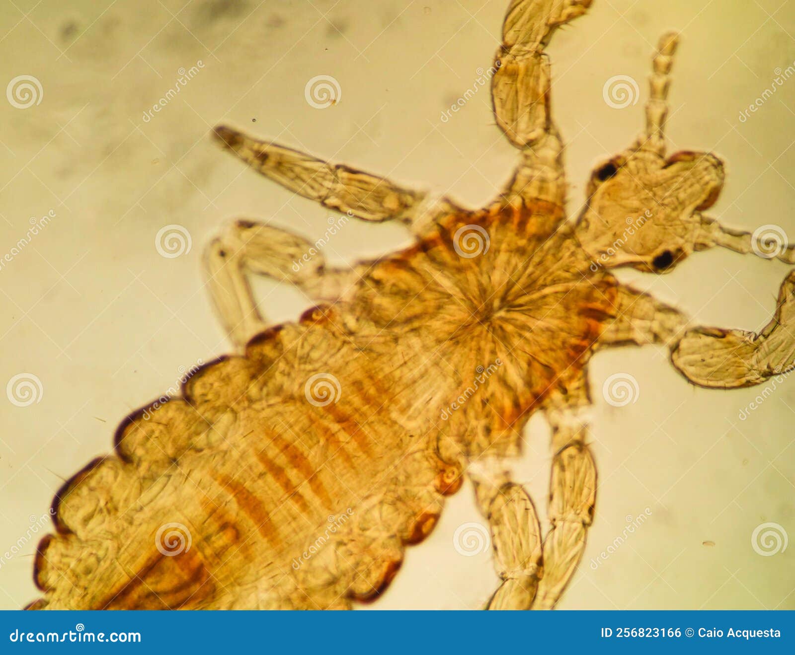 Human Louse, Pediculus Humanus, Slide Plate Under High Magnification in