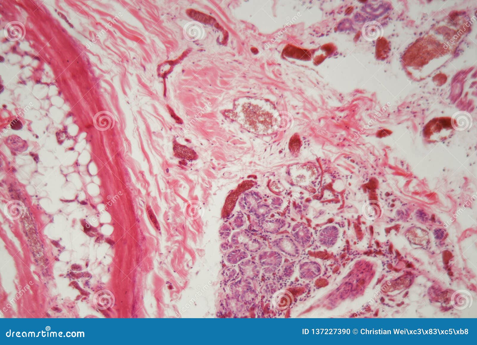 Healthy Lungs Stock Photos And Images 123rf Healthy Lungs Stock Photos And Images 123rf