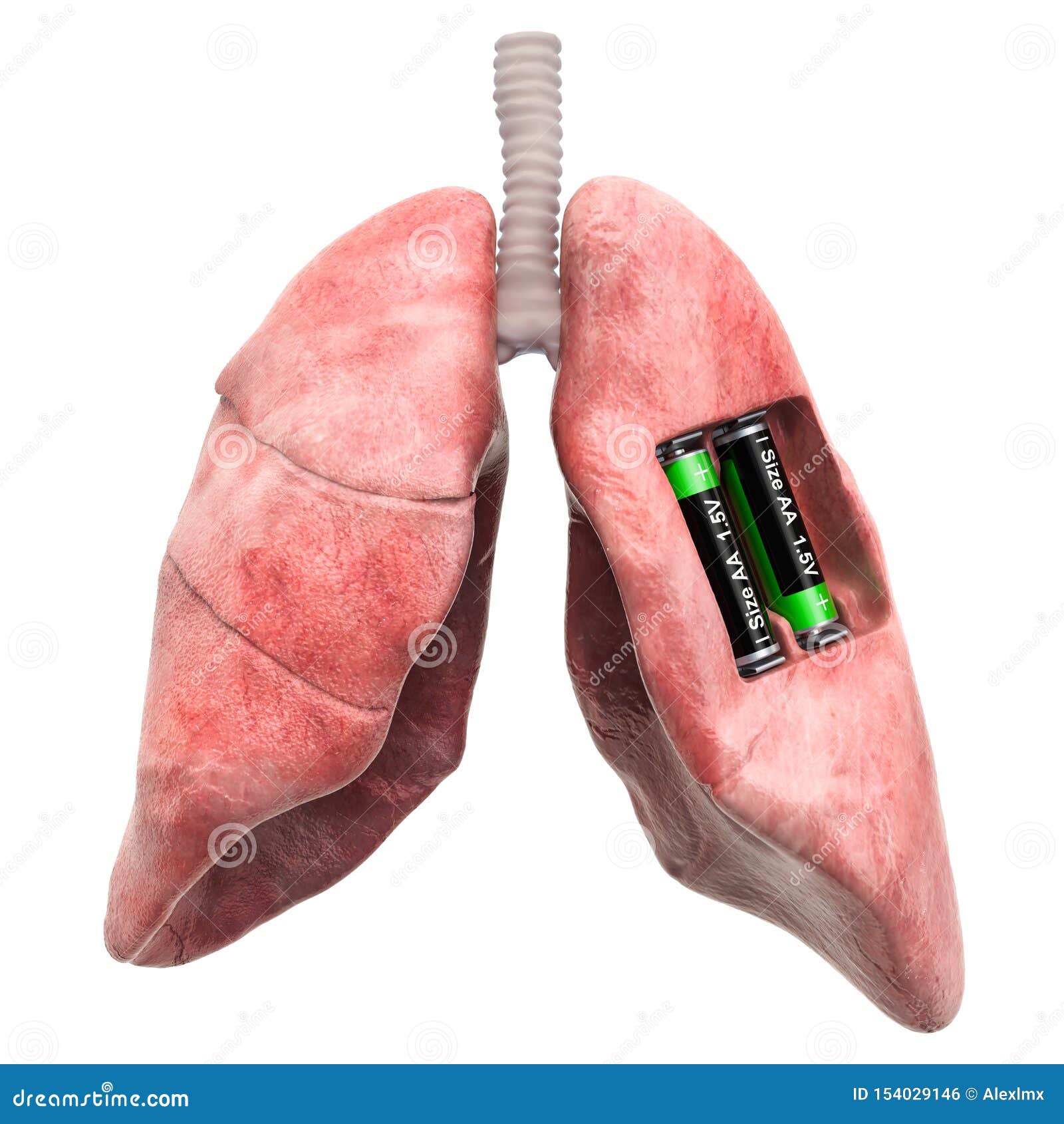 Why does lung cancer present as laryngitis