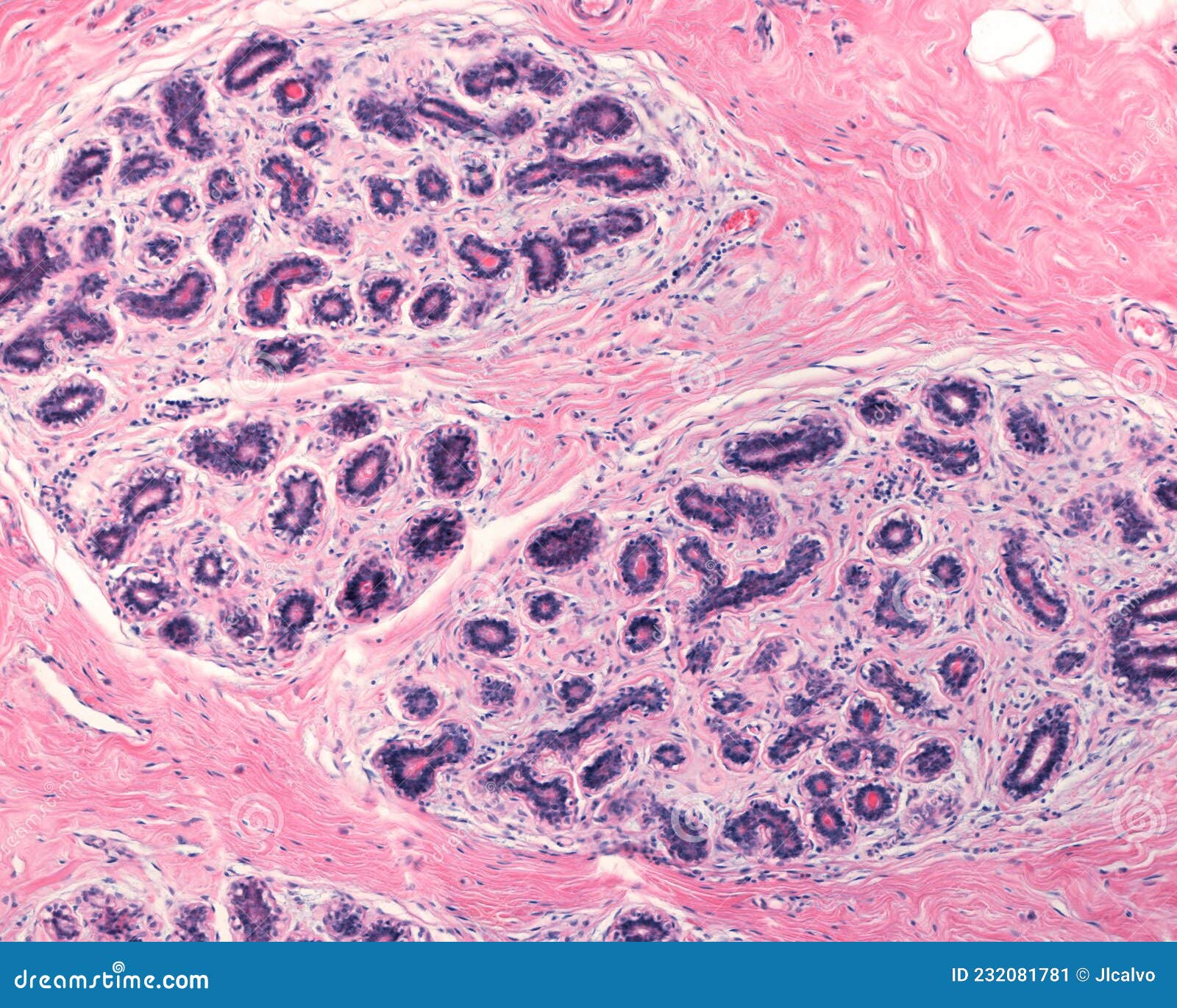human mamary gland. tdlu