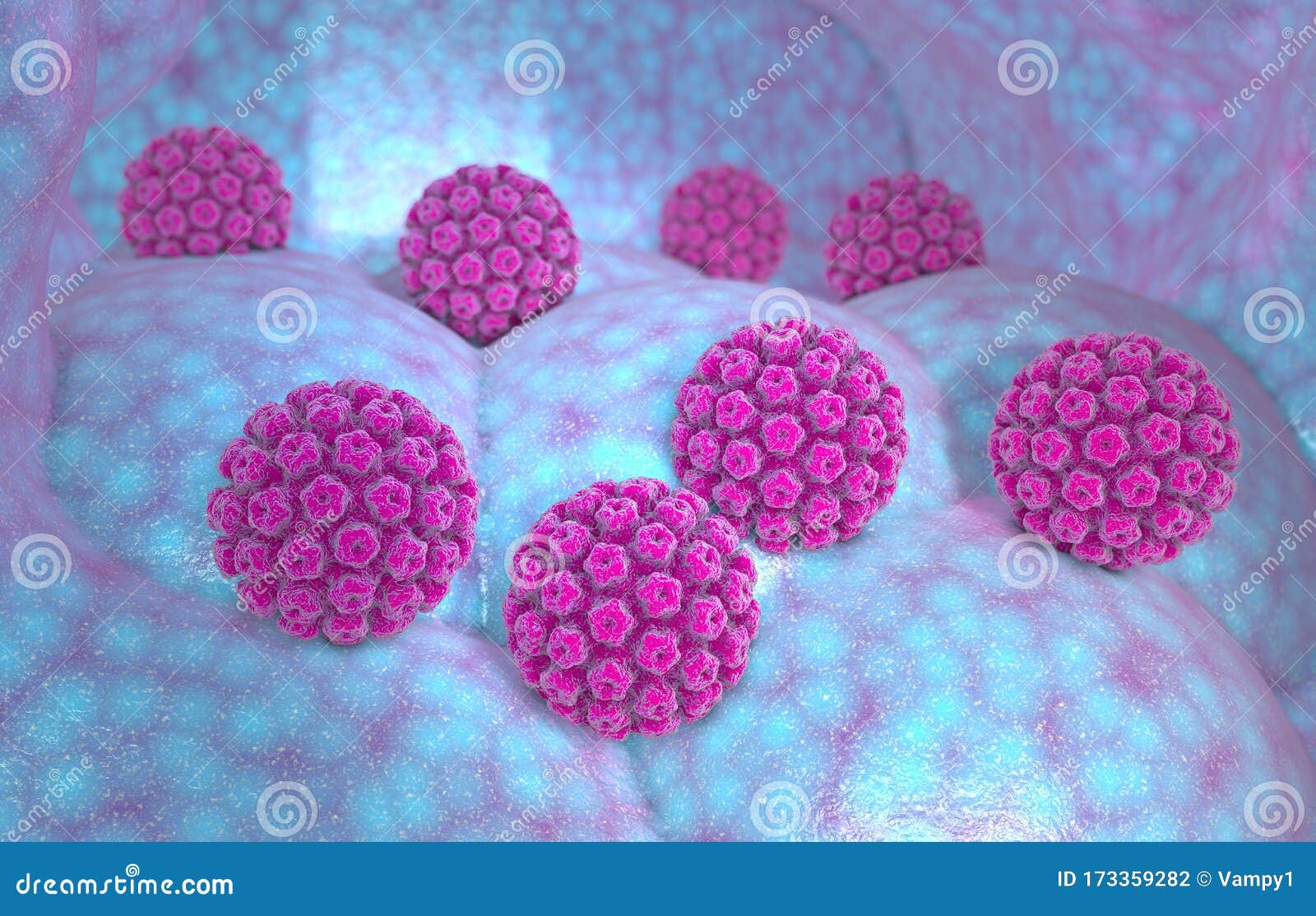 human papillomavirus infection. virus. hpv is the most common sexually transmitted infection globally.