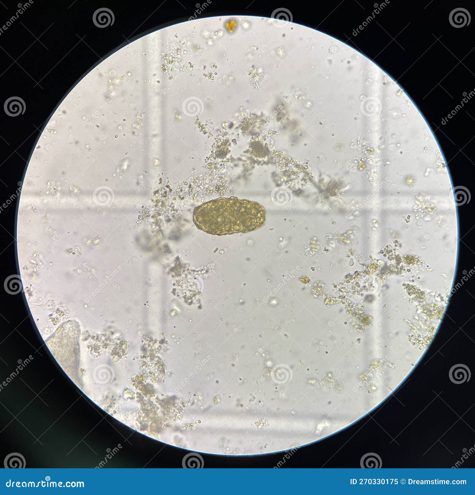 Human Parasite in Stool Examination. Stock Image Image of anatomy