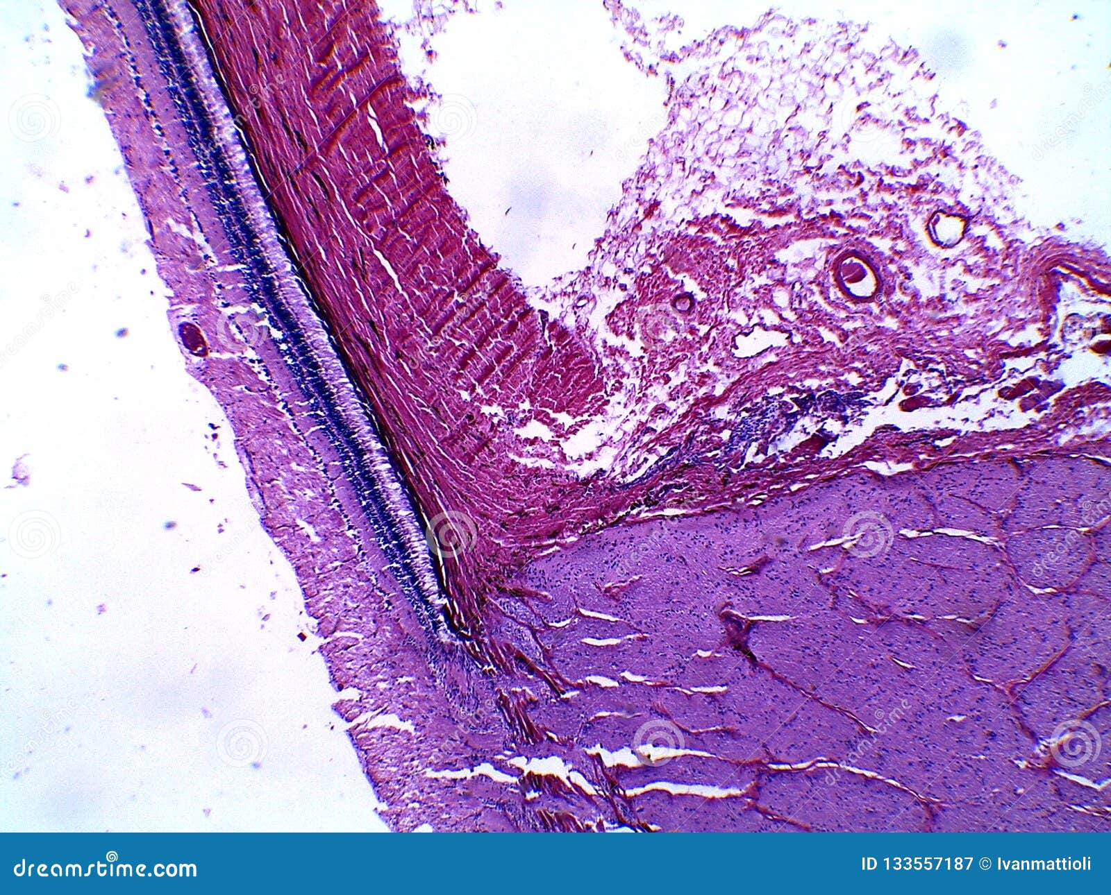 human retina and part of the blind spot under the microscope