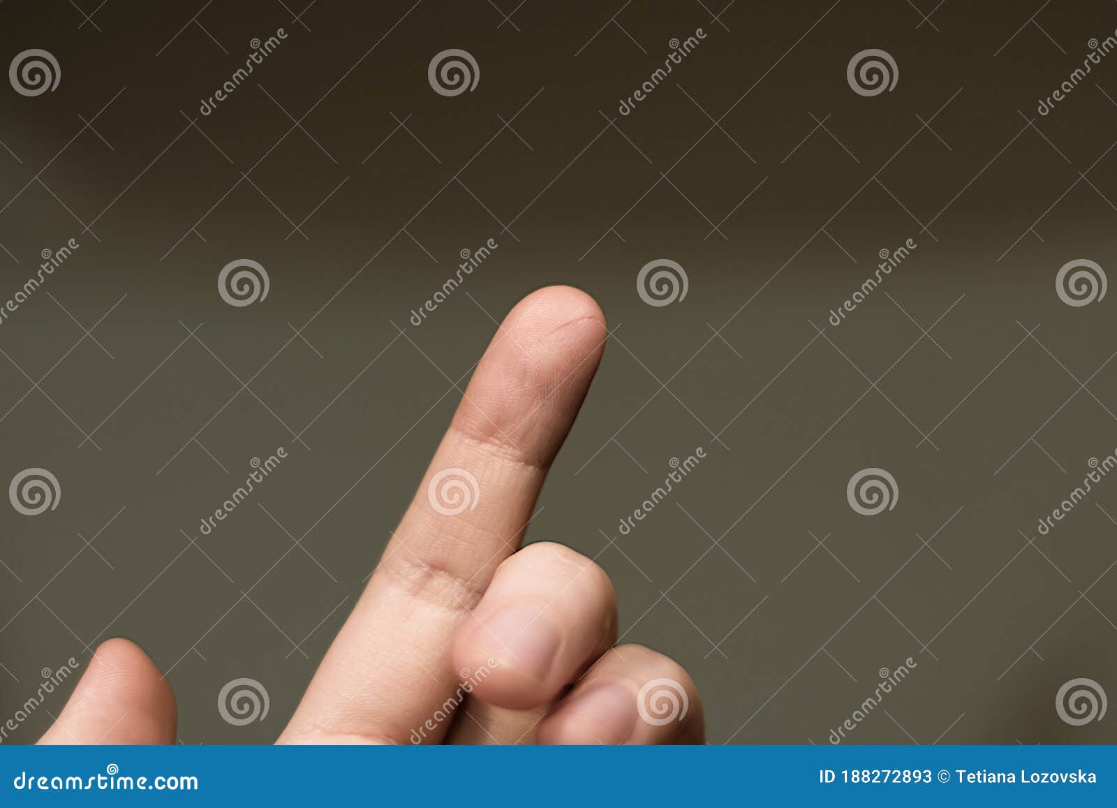 Human`s Hand with a Small Cut on Fingertip Stock Image Image of