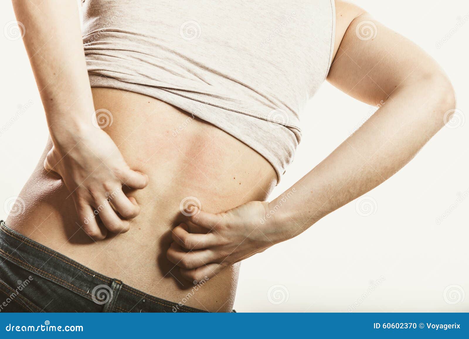 Human Scratching Itchy Back Skin. Rash. Stock Photo 