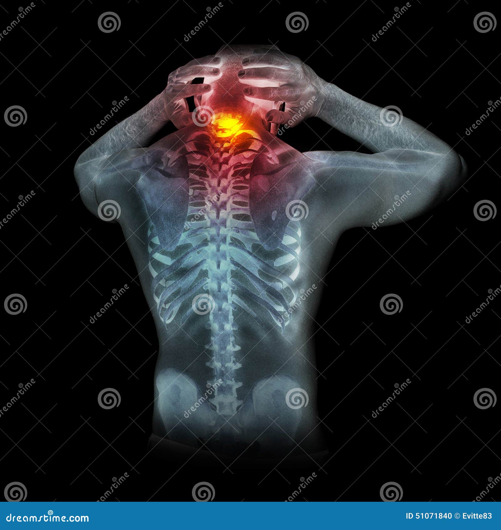 Human Skeleton Under The X Rays Isolated On Black Background Stock