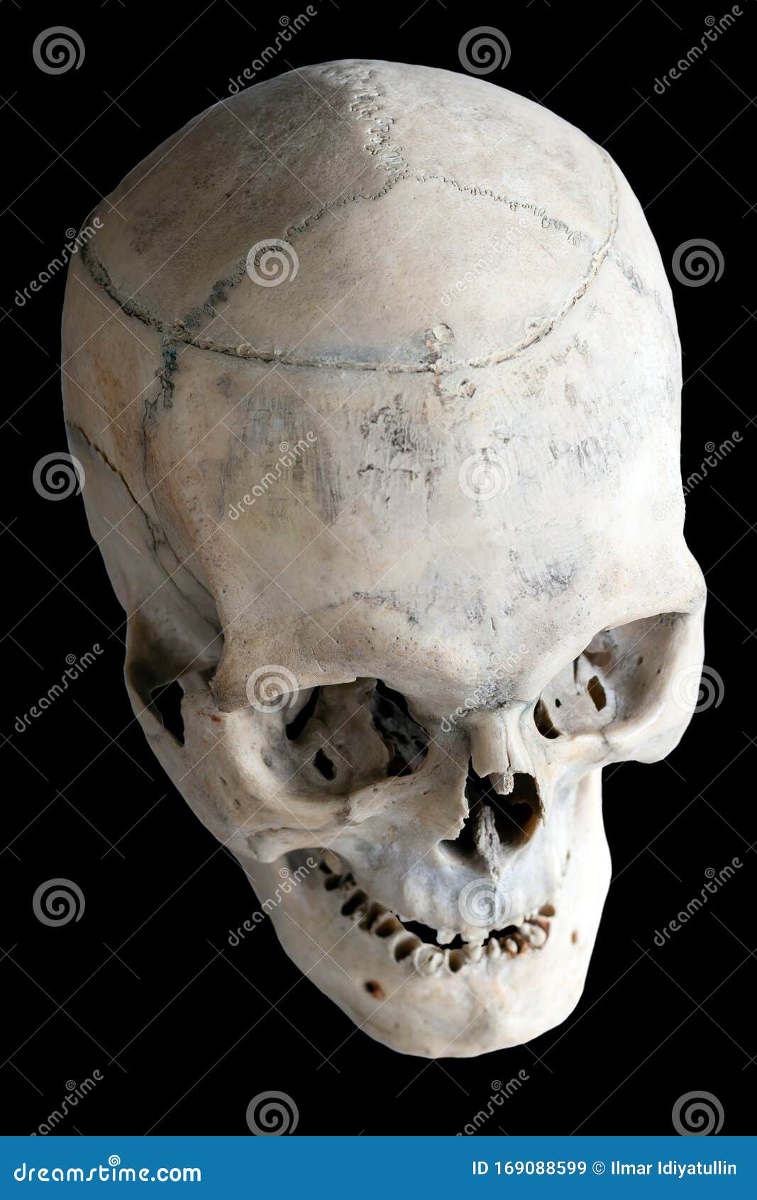 krig at føre lemmer The Human Skull. Top View, Side View. Human Anatomy. Isolated on a Black  Background Stock Image - Image of halloween, mystery: 169088599