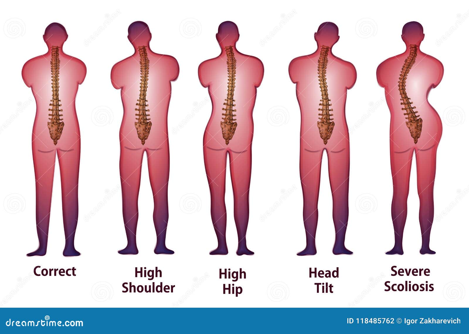 14,500+ Spine Posture Stock Photos, Pictures & Royalty-Free Images