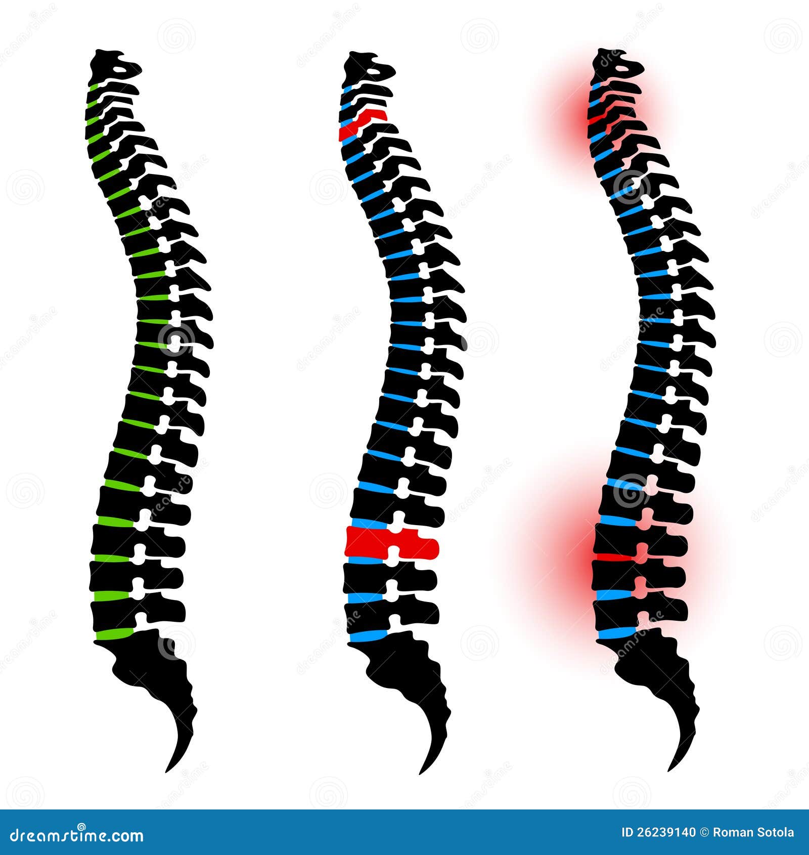Human Spine Drawing