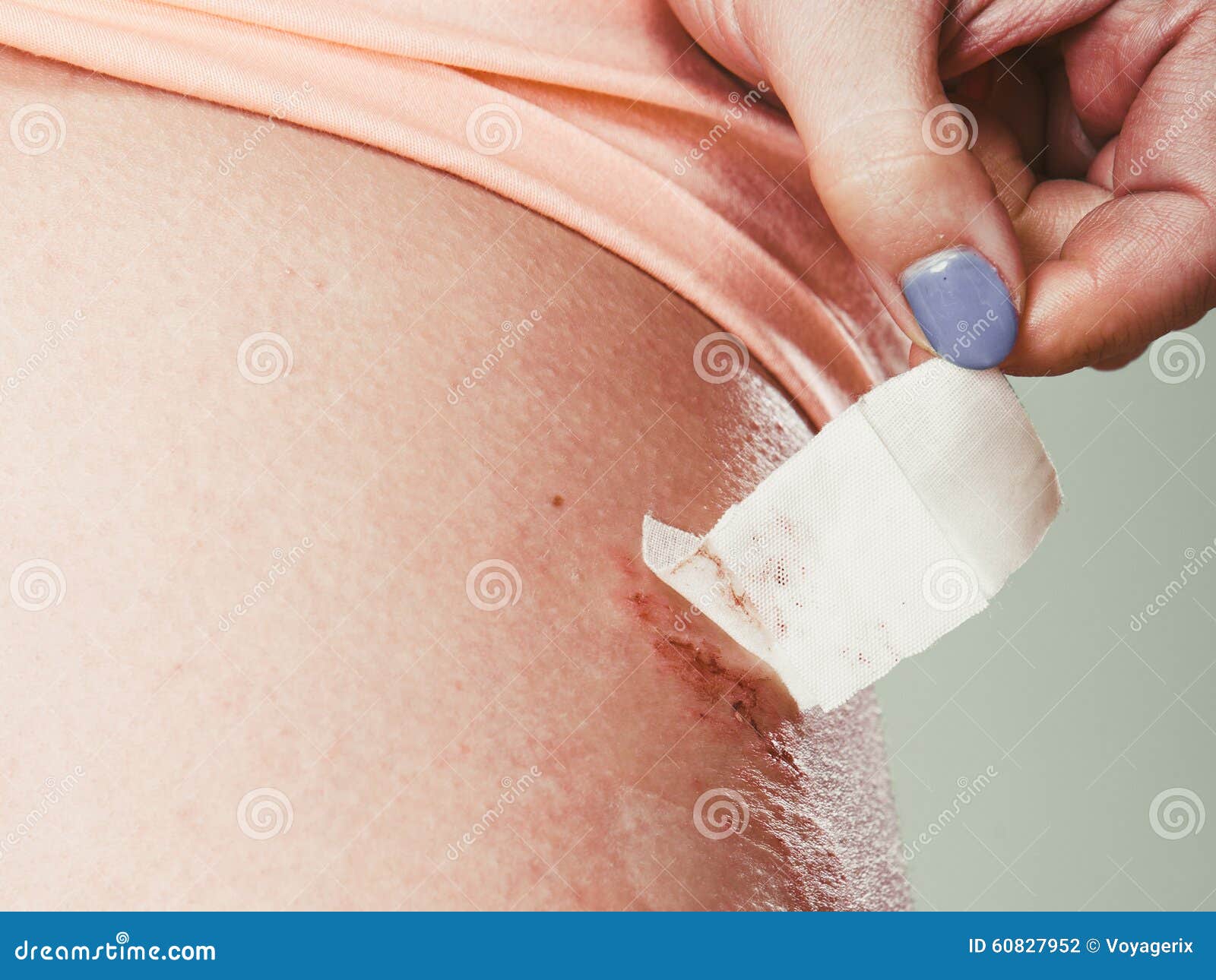 Closeup Of Human Hand Sticking Plaster Adhesive Bandage To Wound