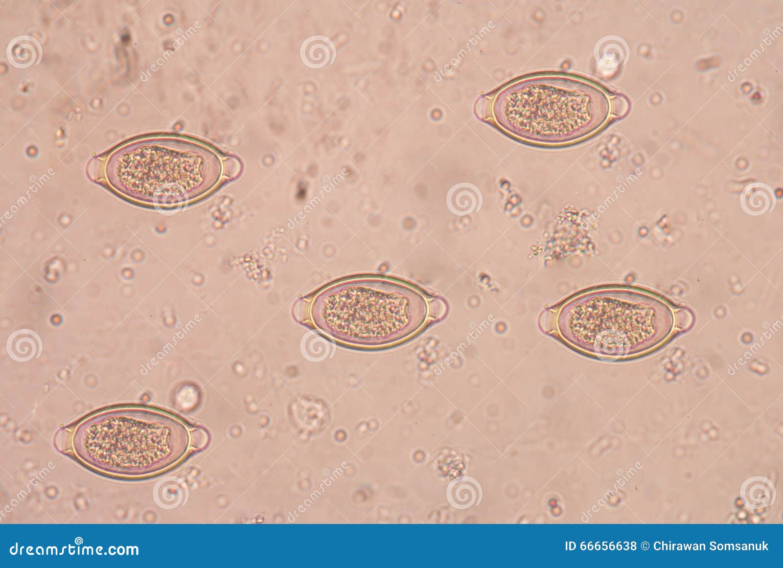 Helminták tünetei trichocephalosis Pinworm trichocephalosis