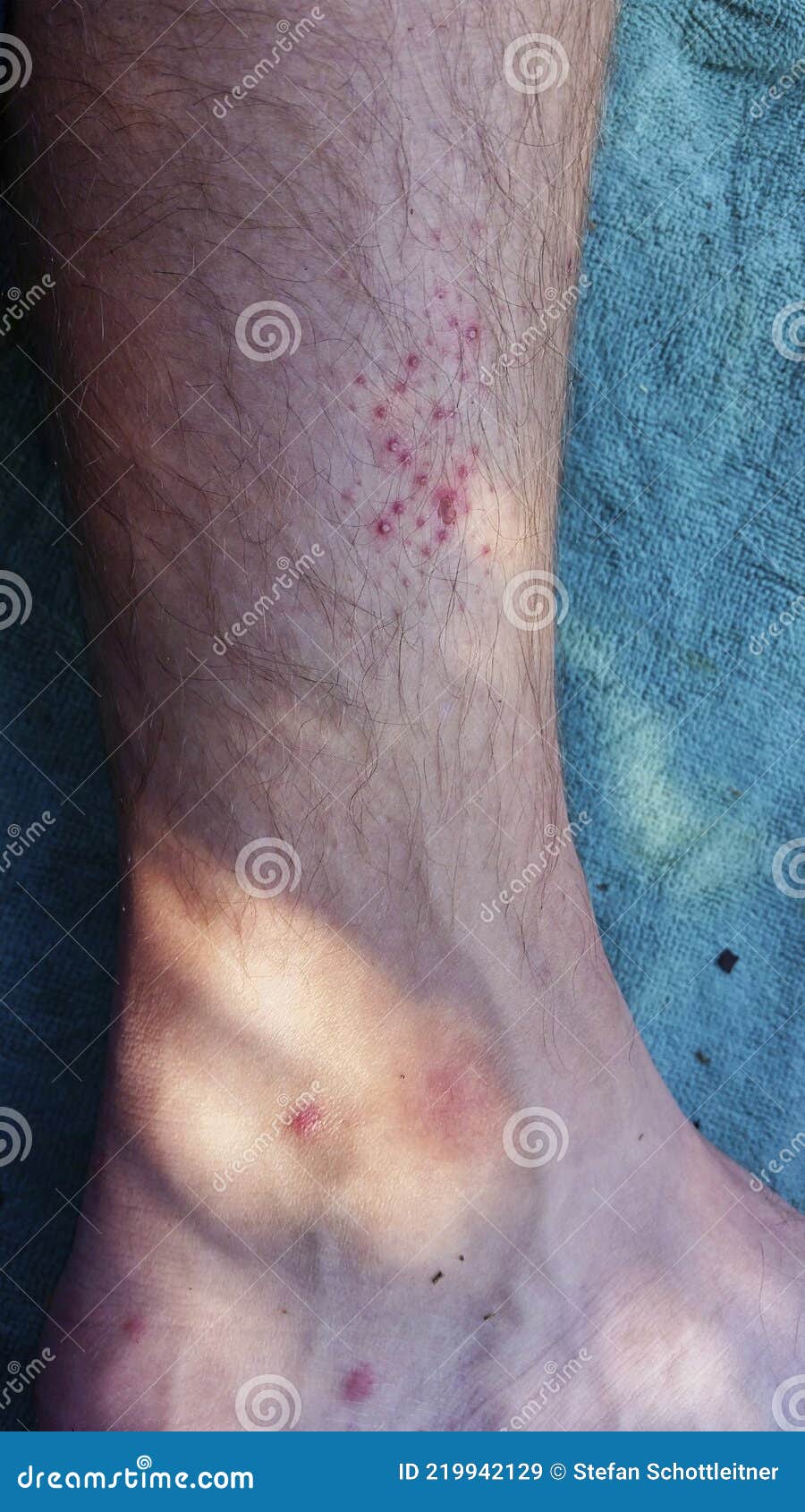 A Hurt Leg after a Long Walk Stock Image Image of animal, vintage