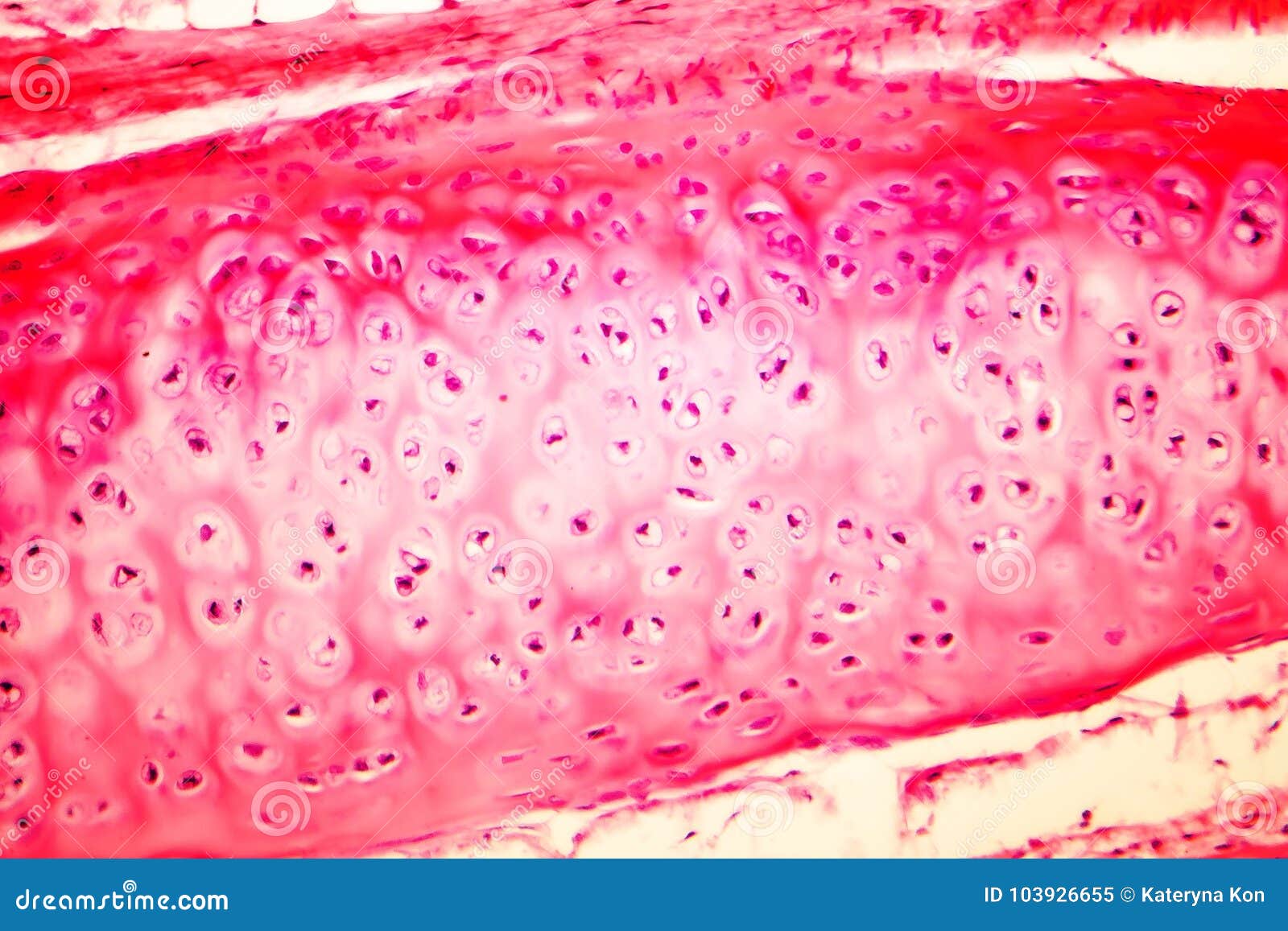 hyaline cartilage of human trachea