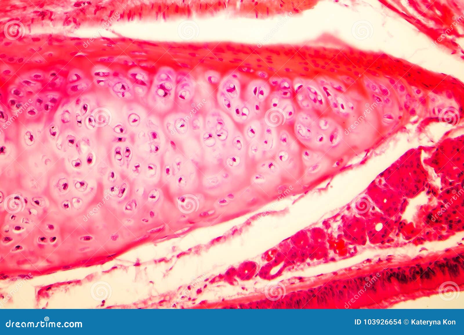 Hyaline Cartilage of Human Trachea Stock Photo - Image of hematoxylin