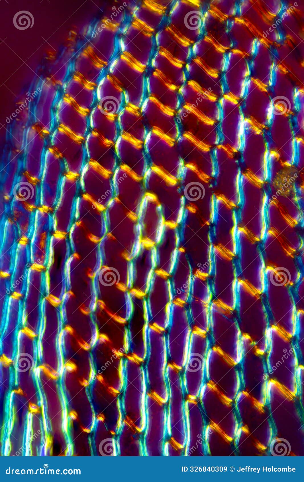 hyaline cells of stem leaves from sphagnum squarrosum lacking fibrils