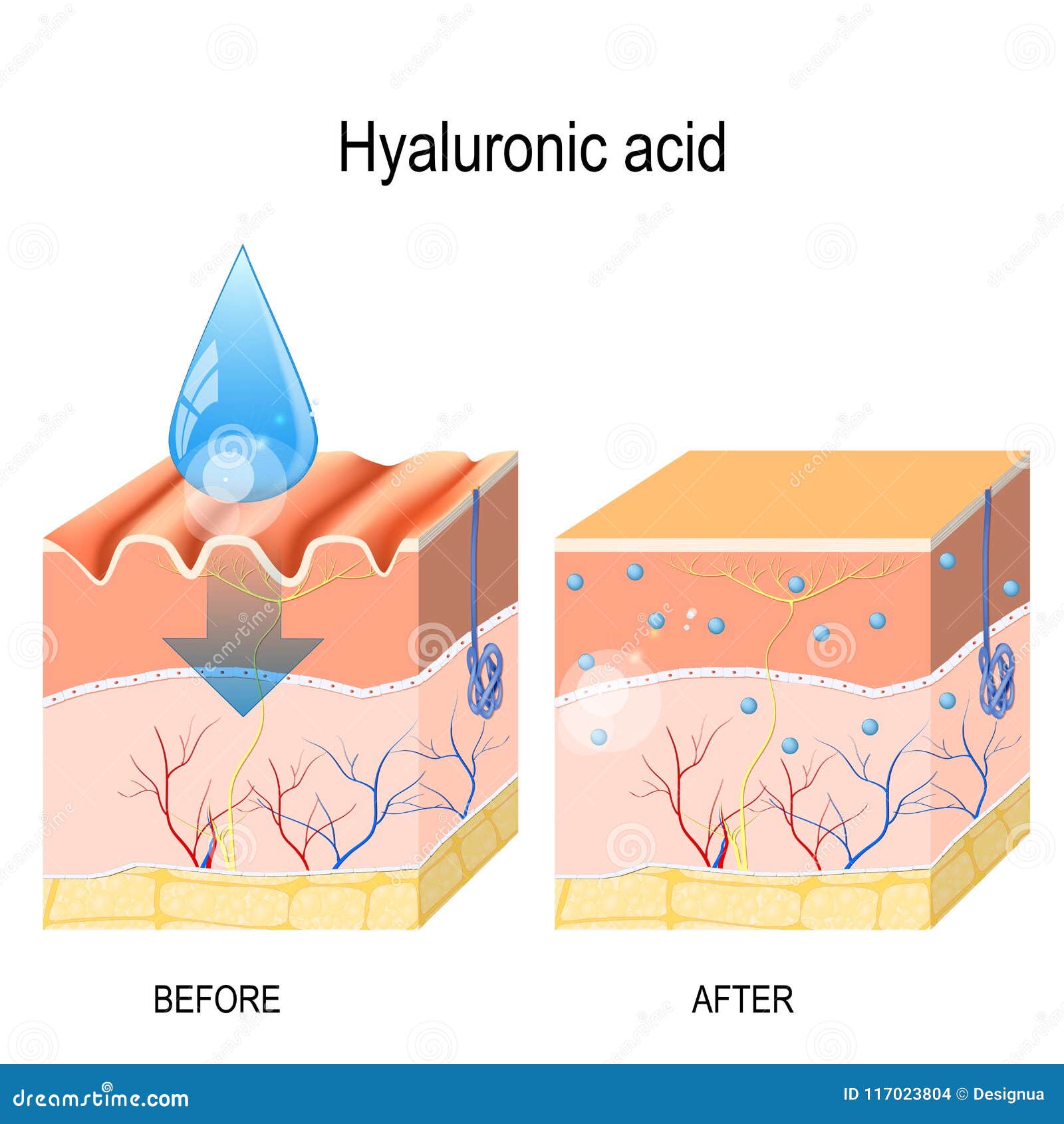 hyaluronic acid. skin rejuvenation with help of hyaluronic acid