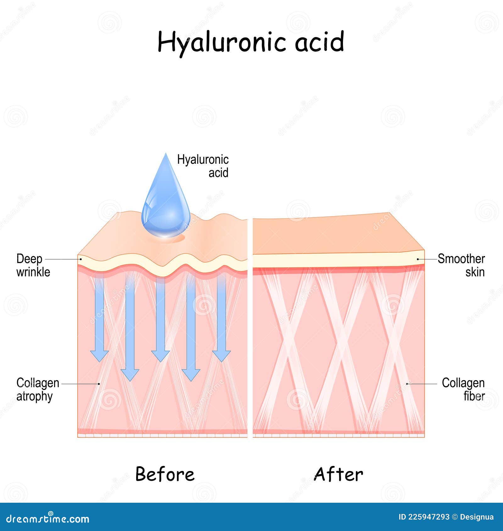 hyaluronic acid. skin