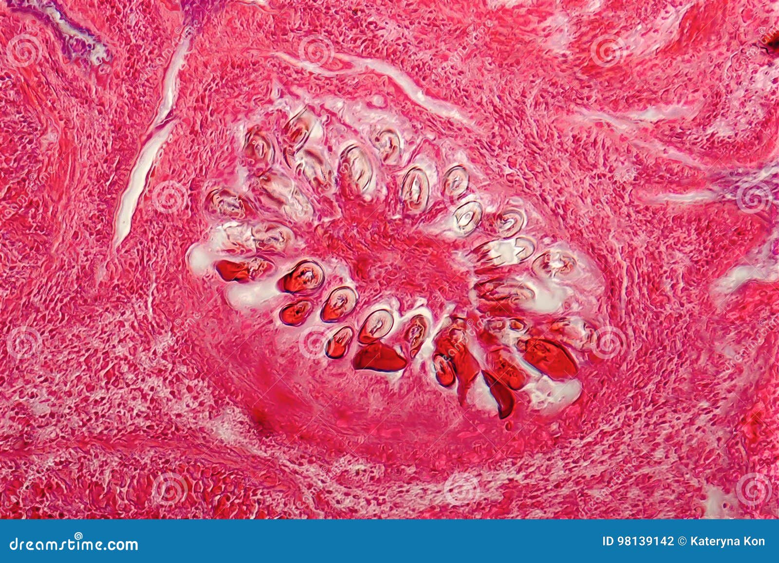 Hydatid Cyst Under The Microscope 100x. Echinococcus Granulosus. Dog
