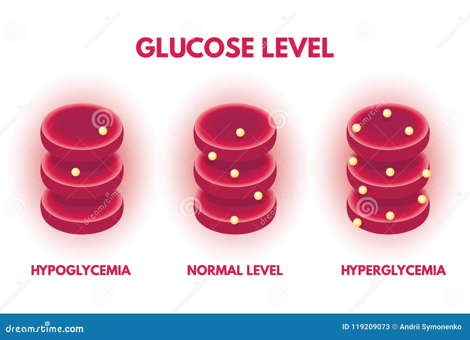 hyperglycemia, hypjglycemia human glucose levels isometric.