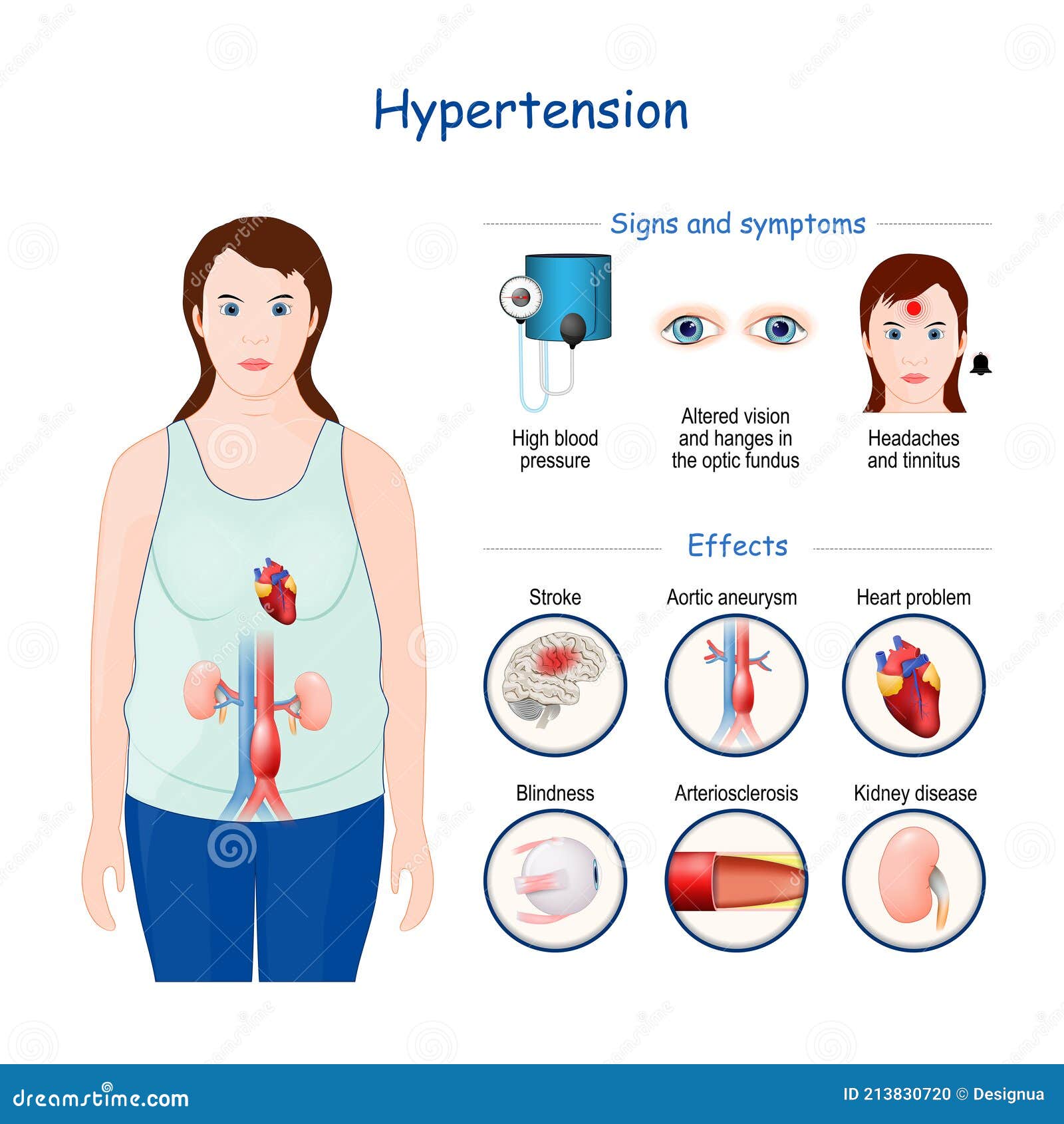 high blood pressure symptoms and signs)