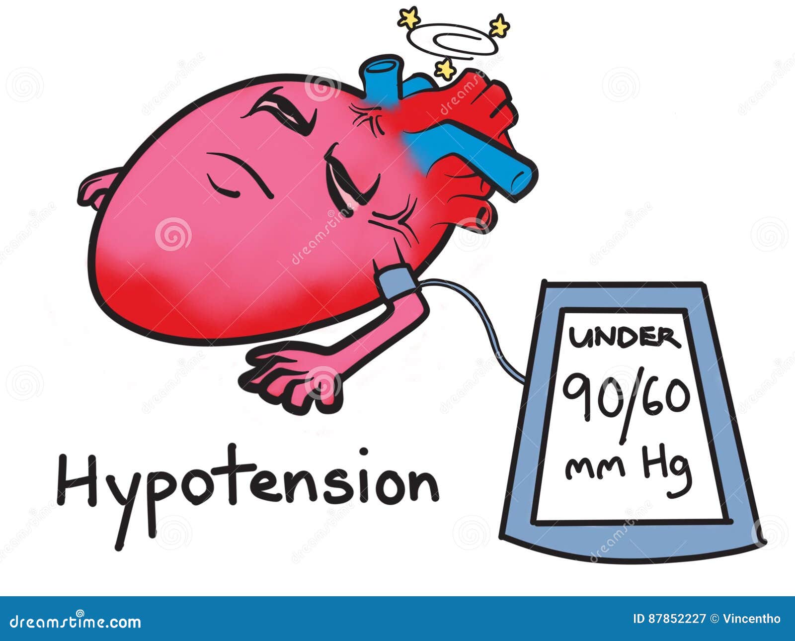 Kết quả hình ảnh cho hypotension