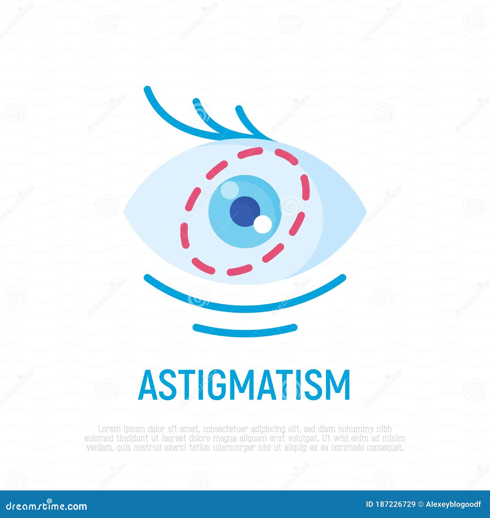 astigmatism oftalmologic