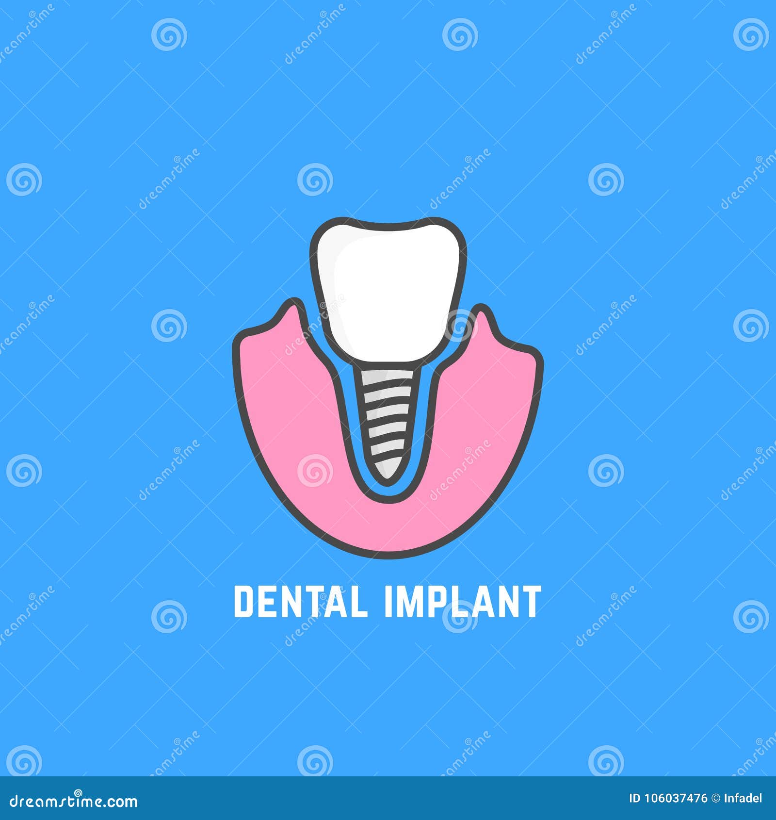 Icono Simple Del Implante Dental Blanco Ilustración del Vector